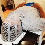 Medzinárodné organizácie podporia nukleárnu medicínu: Sily spoja v boji proti zákernej rakovine Rádioterapia